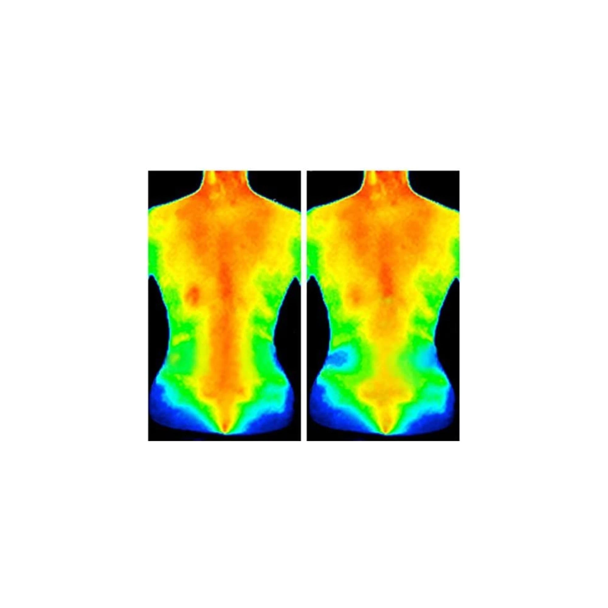 TheraFreeze Ice Cold Therapy For Pain Relief - Image 4